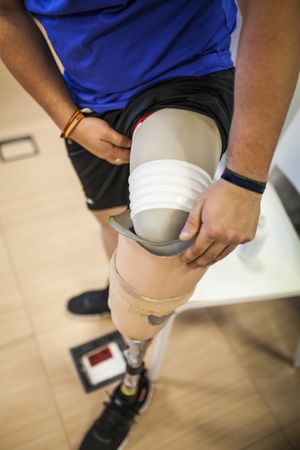 amputated young man testing the new leg prosthesis