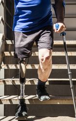 unrecognizable man amputated with crutches testing his new leg prosthesis