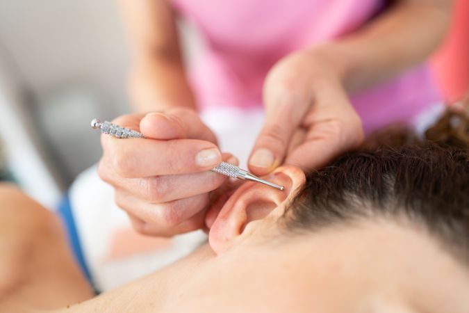 Therapist using ear pen for auriculotherapy treatment