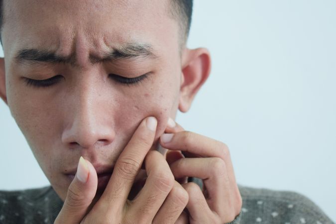Close up of Asian young man touching acne on cheek