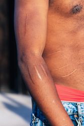 Crop man with scars on body
