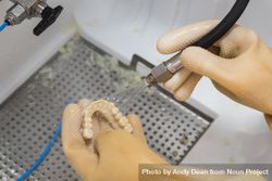 Dental Technician Cleans 3D Printed Dental Implant Bridge 4mWxkX