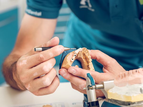 Crop dental technician man making denture on gypsum jaw casts