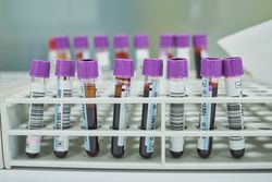 Set of test tubes with blood in donation center