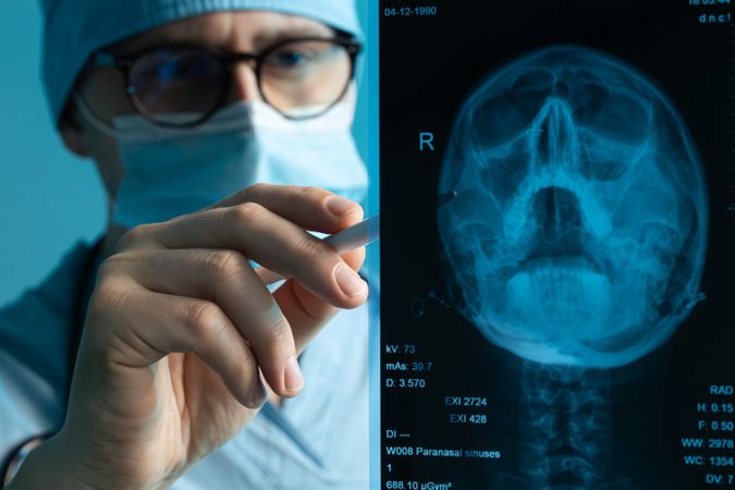 Doctor analyzing skull X-ray with stylus