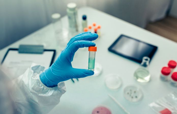 Scientist hand showing vial with vaccine
