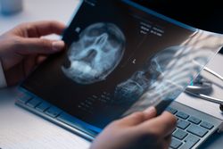 Doctor Examining X Ray in Office