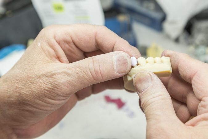 Dental Technician Working On 3D Printed Mold For Tooth Implants