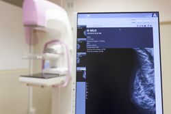 Modern digital mammography unit at clinic