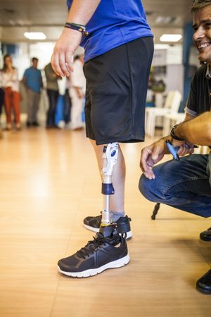 man helping amputated young man testing the new leg prosthesis
