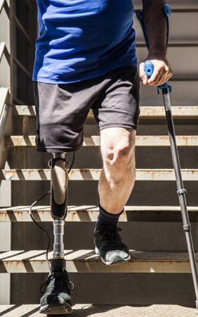 unrecognizable man amputated with crutches testing his new leg prosthesis