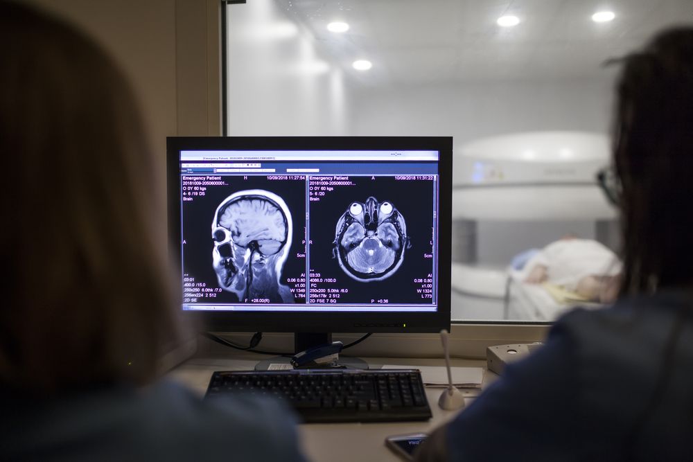 open magnetic resonance machine