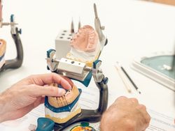 Crop dentist technician putting jaw casts on articulator