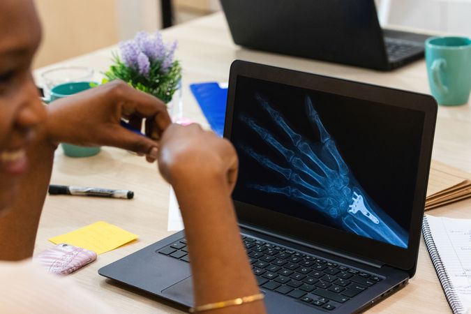 Crop Black doctor sitting at table with x ray image on laptop