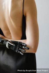 Back view of woman with prosthetic hand 0PJDm4