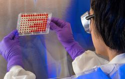 A CDC scientist examines the results of a hemagglutinin inhibition test 5XYQP4