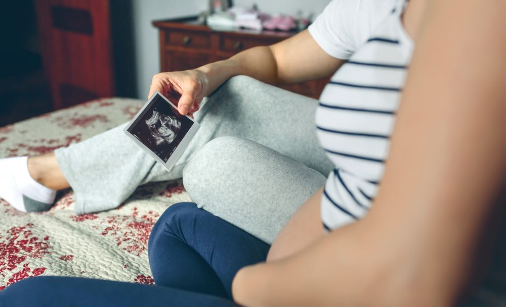 Couple looking at ultrasound of their baby
