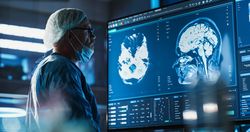 White Male Neurosurgeon Looking At TV Screen With Brain MRI Scans Of Patient, Analyzing, Preparing For Complicated Neurosurgery, Wearing Surgical Gown.