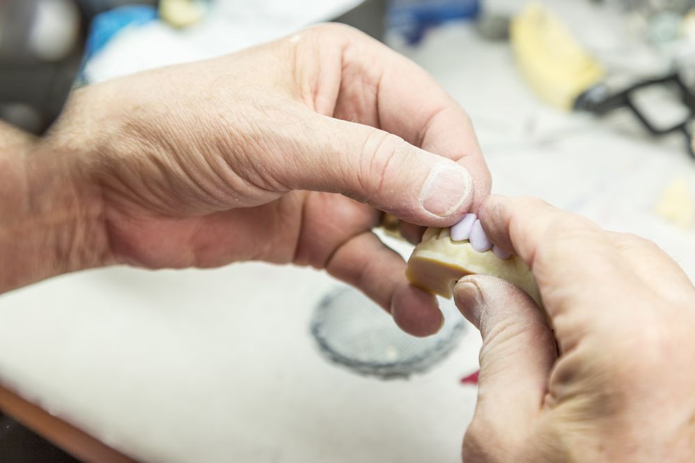 Dental Technician Working On 3D Printed Mold For Tooth Implants