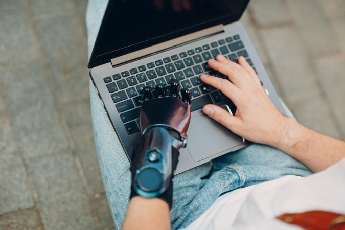 Cropped image of a person with prosthetic hand using laptop