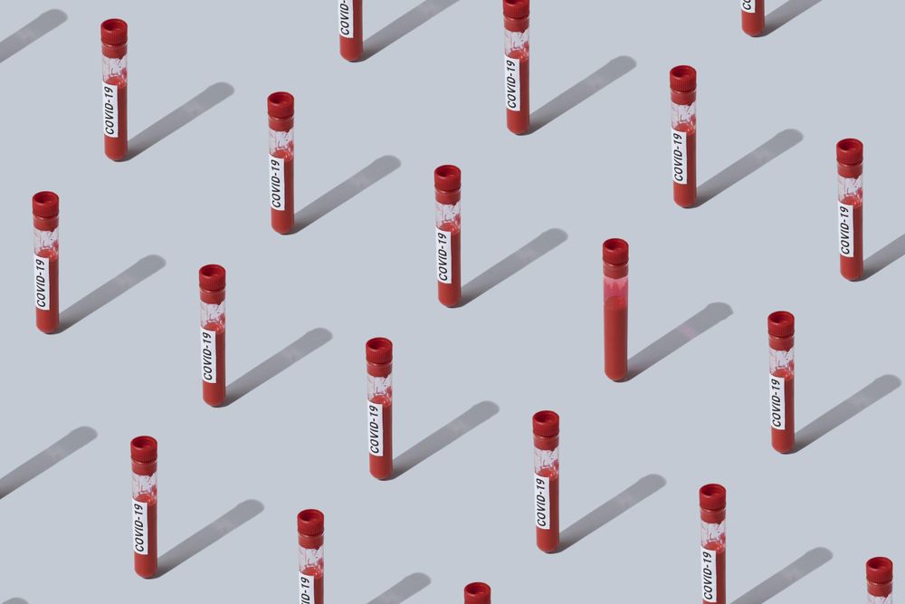 Pattern of vials of blood labelled with “COVID-19”