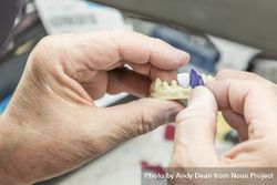 Dental Technician Working On 3D Printed Mold For Tooth Implants 41lWkg