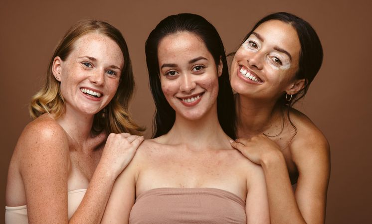 Group of young women accepting their beauty flaws