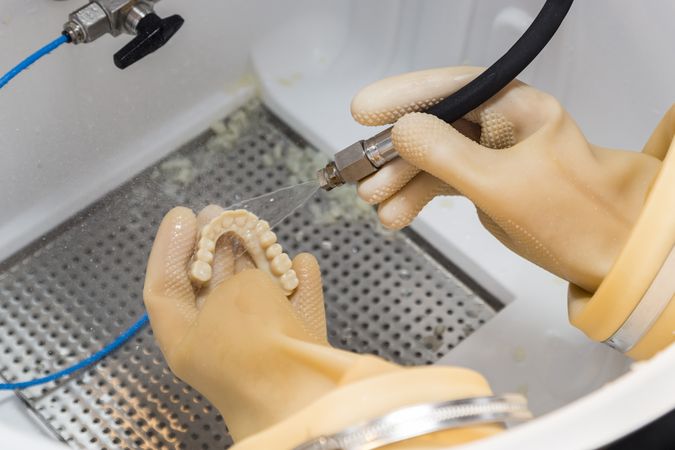 Dental Technician Cleans 3D Printed Dental Implant Bridge