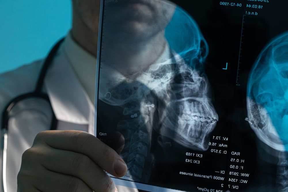 Doctor examining skull X-ray film