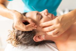 A physiotherapist performs a facial acupuncture session on her patient to tone the muscles of the face
