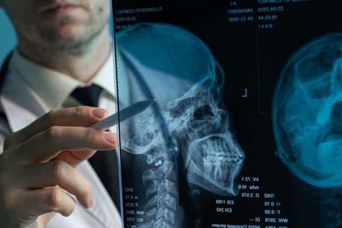 Doctor analyzing skull X-ray with stylus