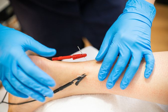 Physio professional in latex gloves doing electro acupuncture on patient’s leg