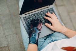 Cropped image of a person with prosthetic hand using laptop 4NlKe0