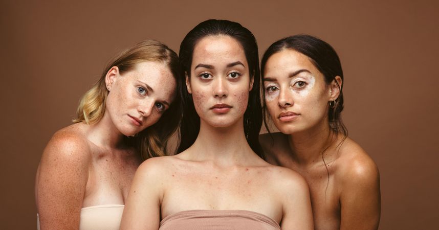Group of women with skin imperfections on their bodies
