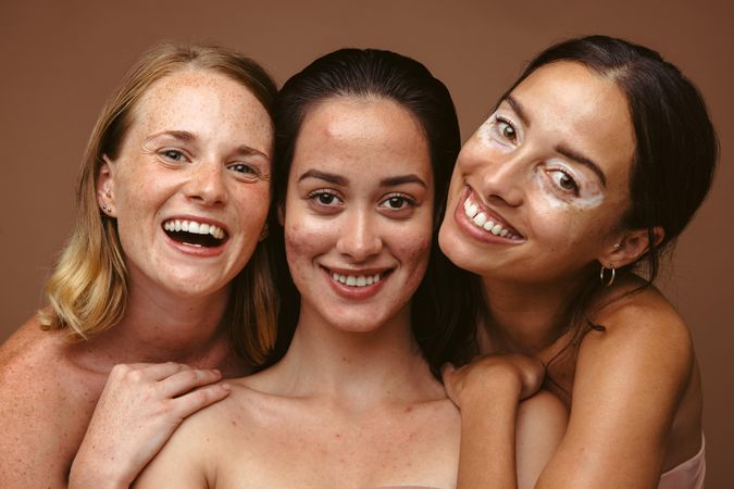 Beauty bloggers showing skin-positivity