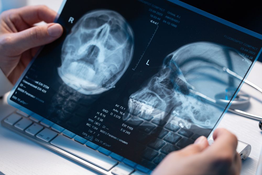 Doctor Examining X Ray in Office