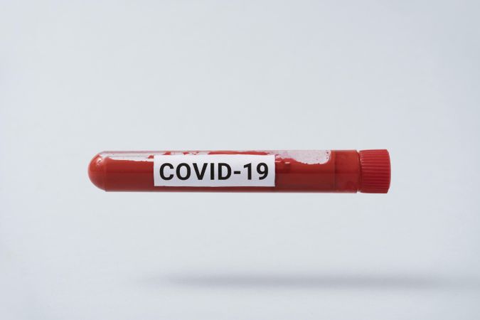 Vial of blood labelled with “COVID-19”