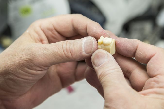 Dental Technician Working On 3D Printed Mold For Tooth Implants