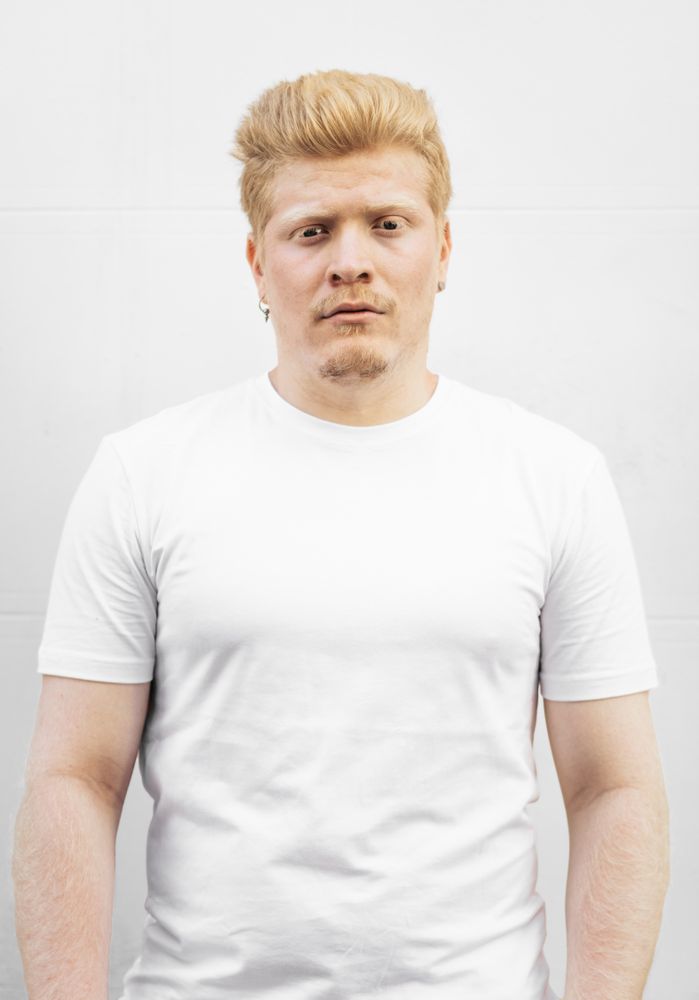 Monochrome: Portrait of an albino Latino man in light clothing against a light background.