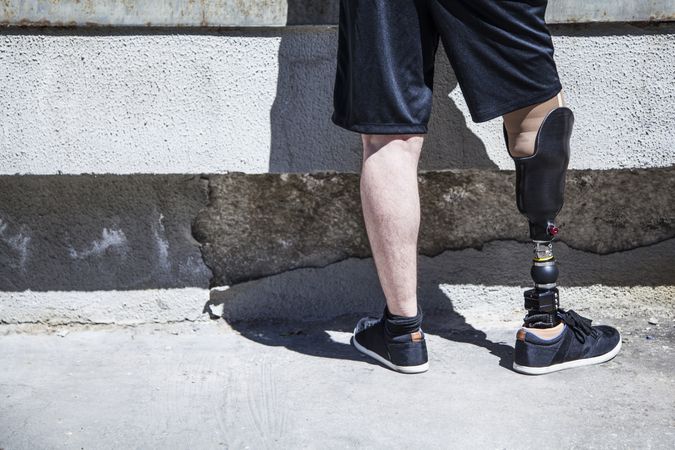 Unrecognizable young man amputated with his leg prosthesis