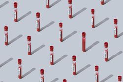 Pattern of vials of blood labelled with “COVID-19”