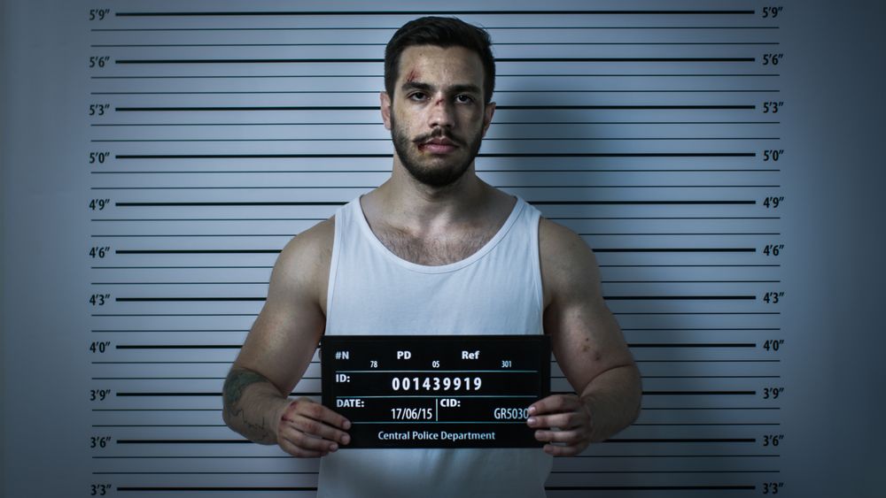 In a Police Station Arrested Beaten Man Poses for Front View Mugshot.