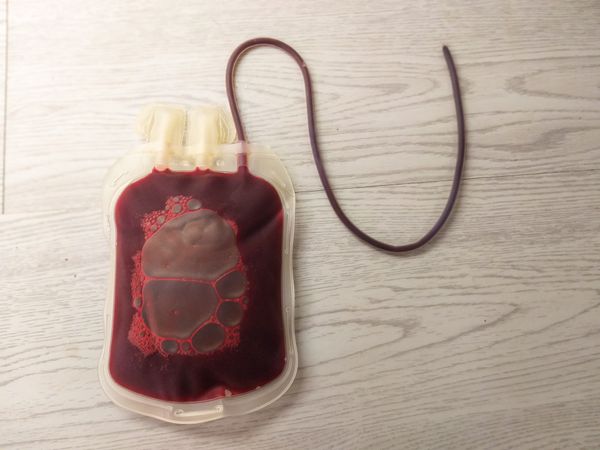 Blood Bag with Tube for Donation or Hospital Blood Bank Stock