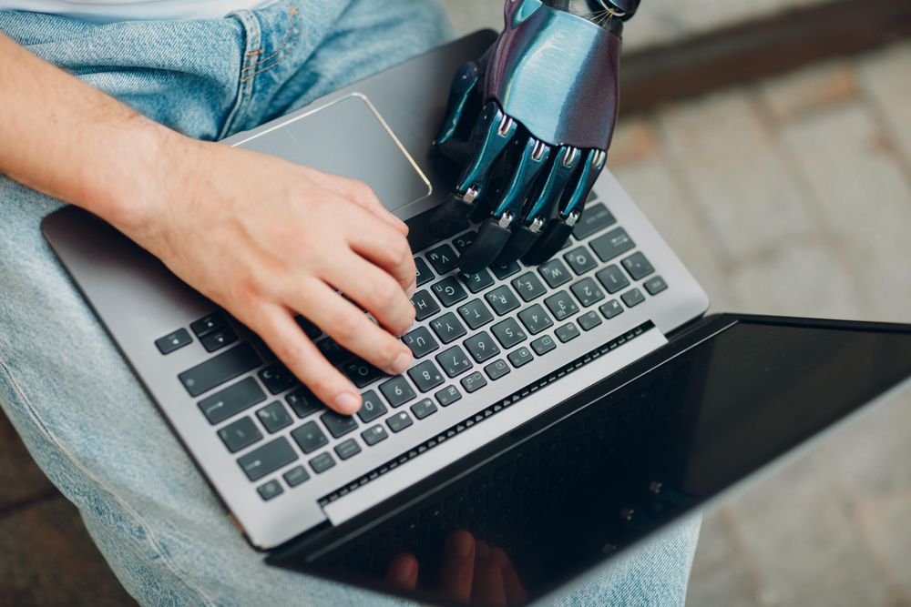 Top view of man with prosthetic hand typing on computer