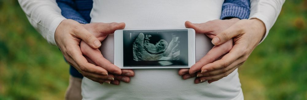 Man showing ultrasound over his wife's belly