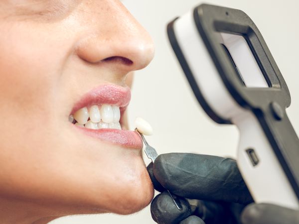 Crop client having teeth color determined by anonymous dentist