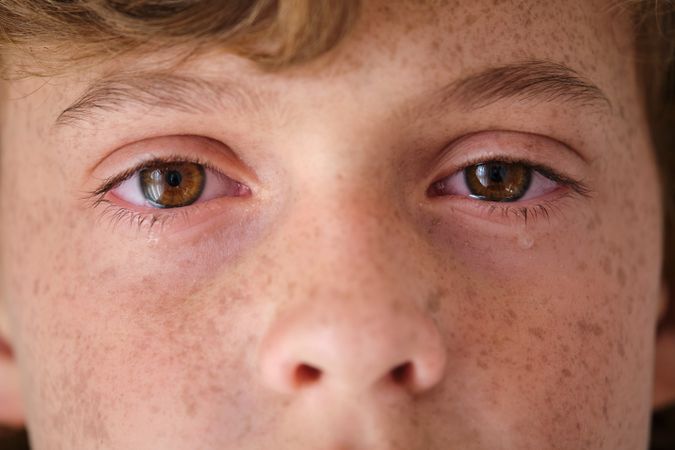 Crop crying child with freckles on face skin