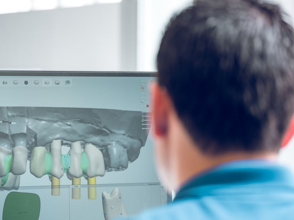 Dentist making 3d denture model on computer