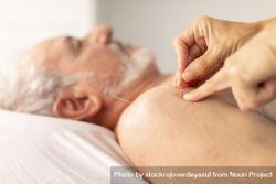 The hands of a physiotherapist placing needles on the shoulder of an older man, during an acupuncture session 5r99r3