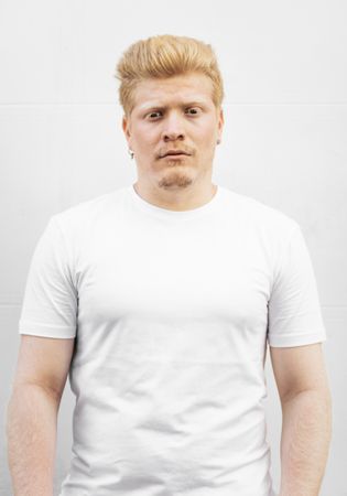 Monochrome: Portrait of an albino Latino man in light clothing against a light background.